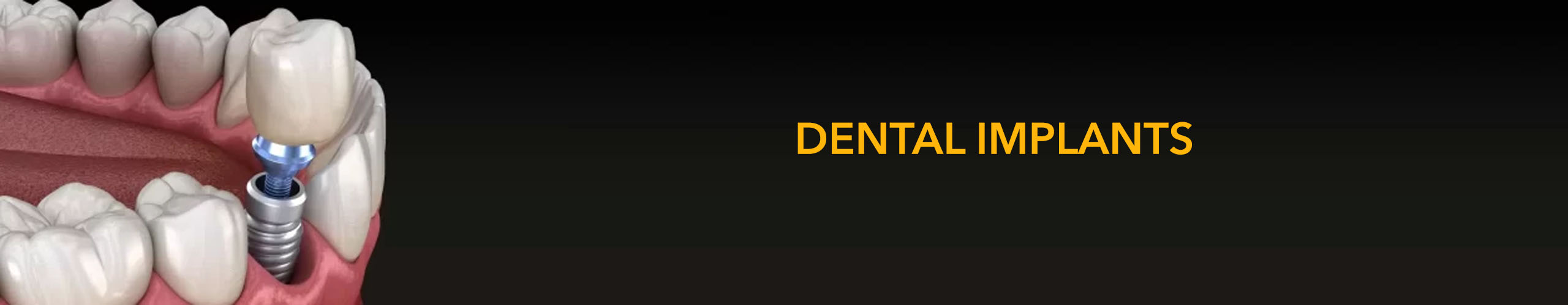 main banner